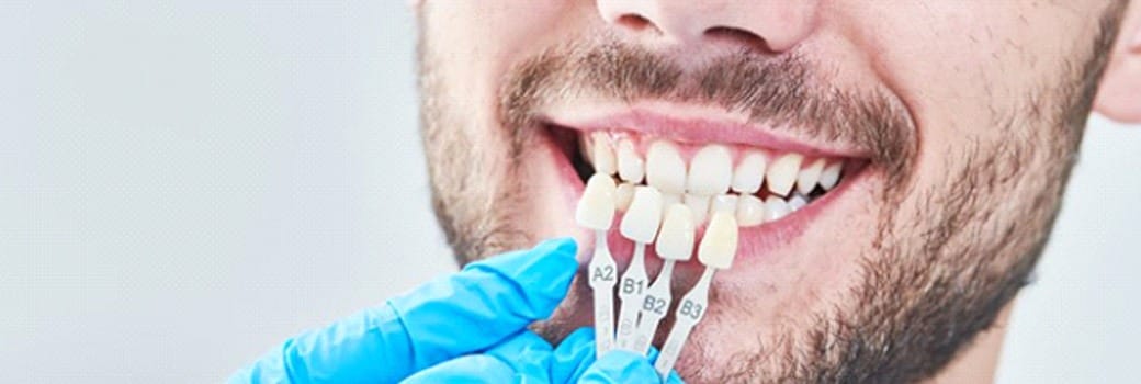 dentist holding veneers up to a patient’s smile