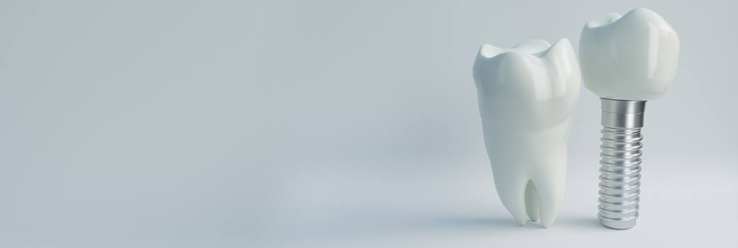 giant dental implant