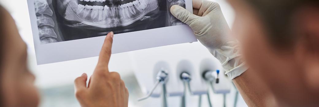 Dental insurance paperwork for the cost of dental implants in Greensboro