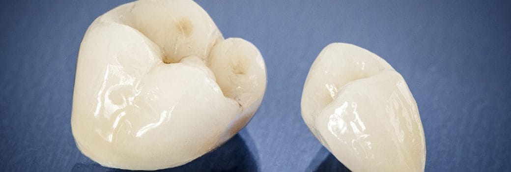 All-ceramic restorations on dental tray