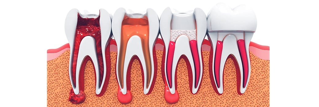 illustration of inside teeth