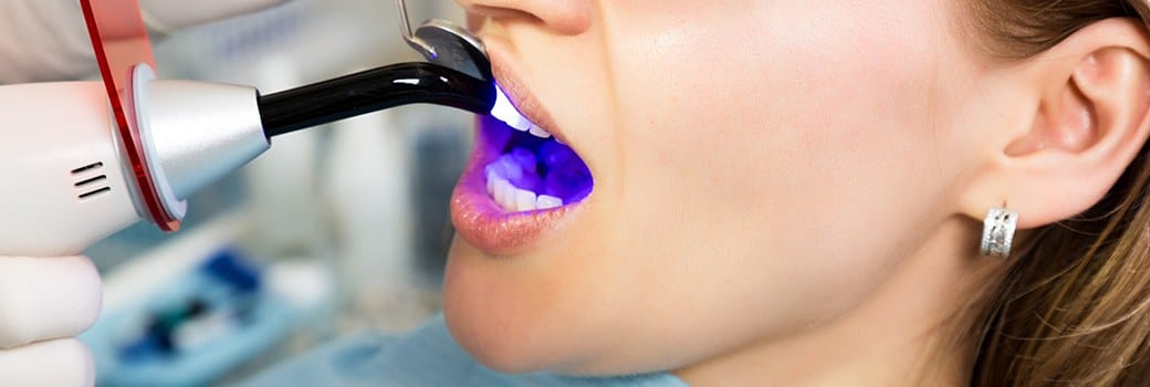 woman having tooth bonding done