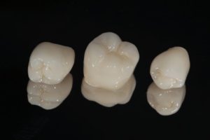 three dental crowns against black background