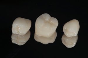 three dental crowns against black background 