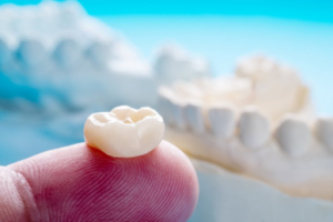 A dental crown resting on a fingertip with plaster models in the background