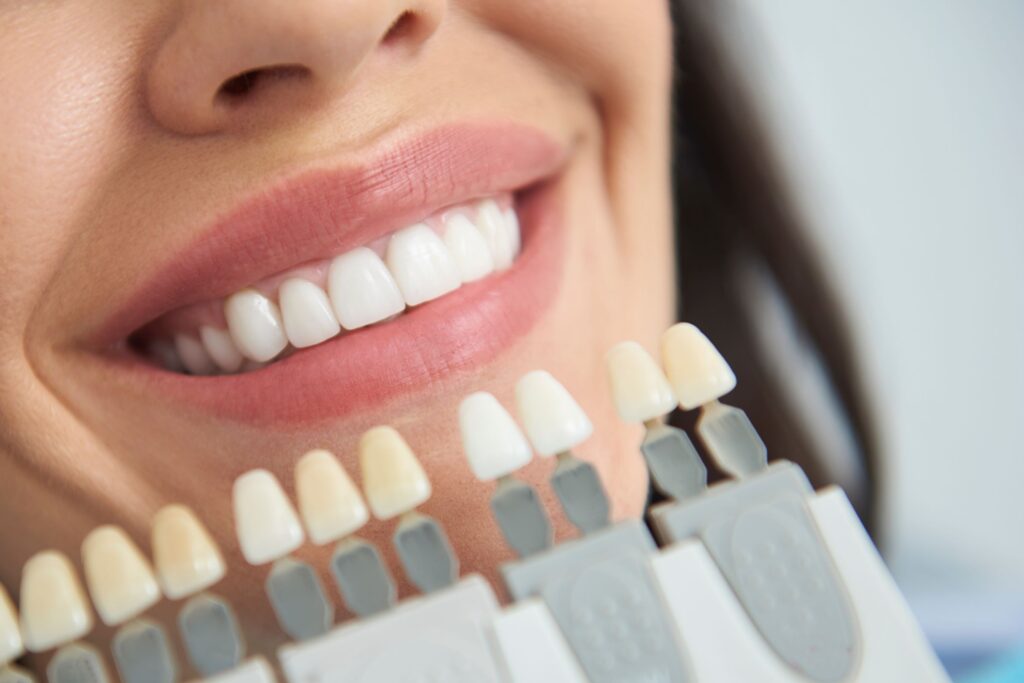 Closeup of shade guide held to woman's teeth