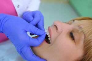Woman replacing her veneers